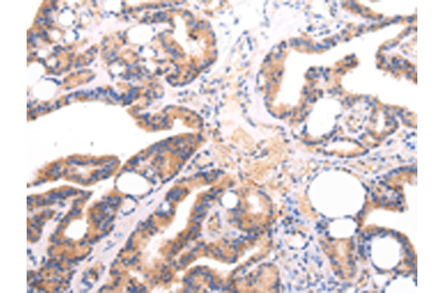 Immunohistochemistry - Lambda Light chain Antibody from Signalway Antibody (43108) - Antibodies.com