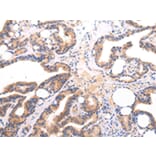 Immunohistochemistry - Lambda Light chain Antibody from Signalway Antibody (43108) - Antibodies.com