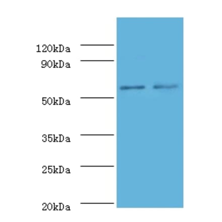 Non-specific lipid-transfer protein Polyclonal Antibody from Signalway Antibody (42318) - Antibodies.com