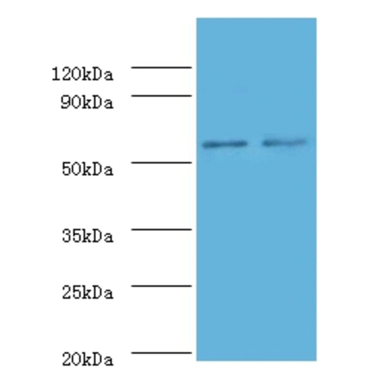 Non-specific lipid-transfer protein Polyclonal Antibody from Signalway Antibody (42318) - Antibodies.com