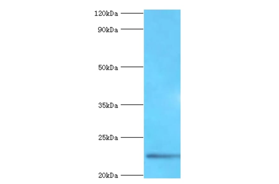 Fibroblast growth factor 21 Polyclonal Antibody from Signalway Antibody (42458) - Antibodies.com