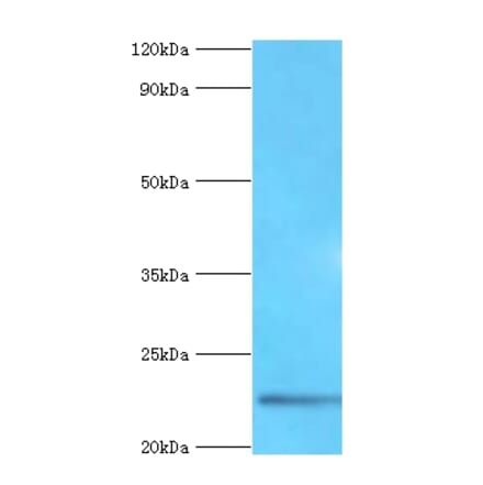 Fibroblast growth factor 21 Polyclonal Antibody from Signalway Antibody (42458) - Antibodies.com