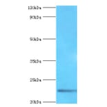 Fibroblast growth factor 21 Polyclonal Antibody from Signalway Antibody (42458) - Antibodies.com