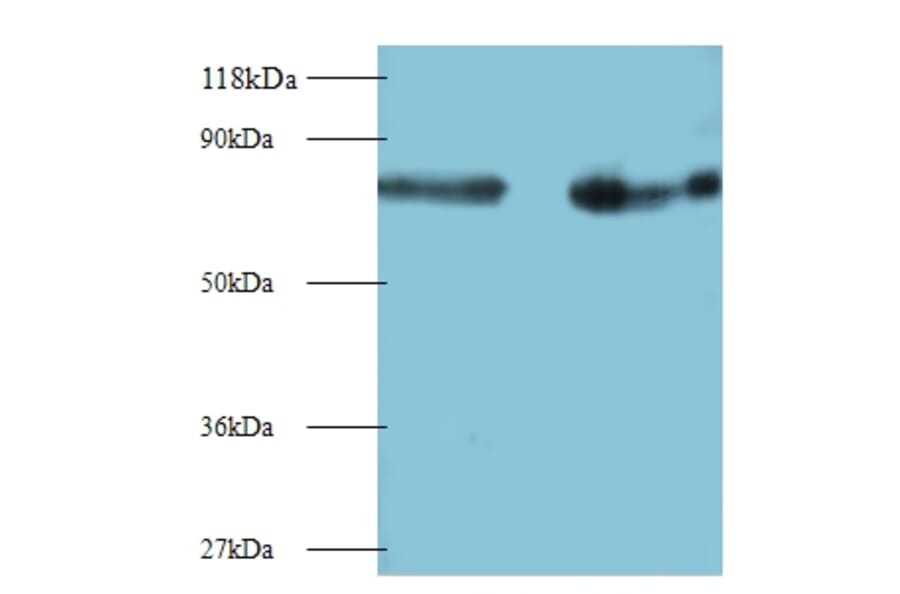 Interleukin-12 subunit beta Polyclonal Antibody from Signalway Antibody (42461) - Antibodies.com