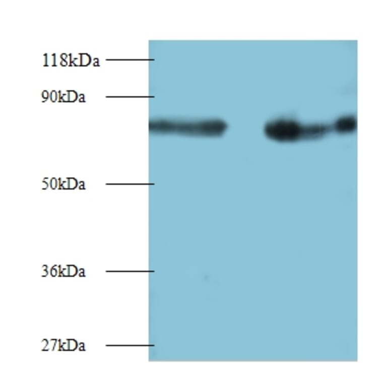 Interleukin-12 subunit beta Polyclonal Antibody from Signalway Antibody (42461) - Antibodies.com