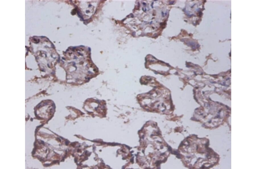 Immunohistochemistry - Interleukin-12 subunit beta Polyclonal Antibody from Signalway Antibody - Antibodies.com