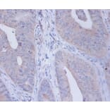 Immunohistochemistry - Interleukin-12 subunit beta Polyclonal Antibody from Signalway Antibody - Antibodies.com