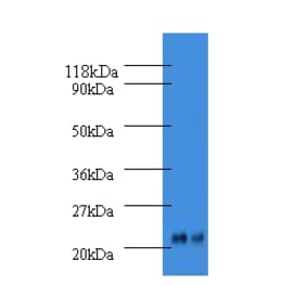 Alpha-1-acid glycoprotein 2 Polyclonal Antibody from Signalway Antibody (42585) - Antibodies.com