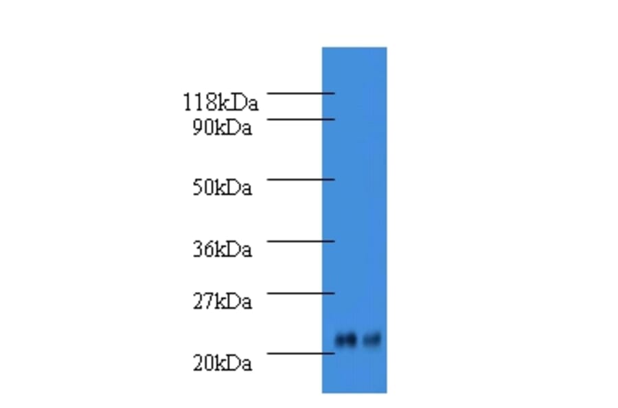 Alpha-1-acid glycoprotein 2 Polyclonal Antibody from Signalway Antibody (42585) - Antibodies.com