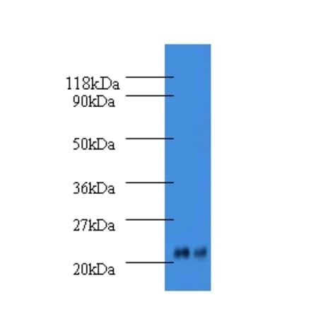 Alpha-1-acid glycoprotein 2 Polyclonal Antibody from Signalway Antibody (42585) - Antibodies.com