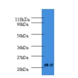 Alpha-1-acid glycoprotein 2 Polyclonal Antibody from Signalway Antibody (42585) - Antibodies.com