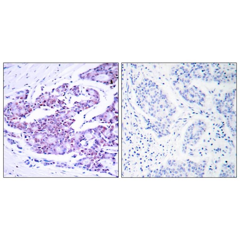 Immunohistochemistry - NFkB-p65 (Ab-468) Antibody from Signalway Antibody (21013) - Antibodies.com