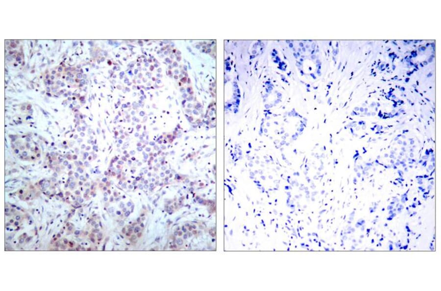 Immunohistochemistry - NFkB-p65 (Ab-536) Antibody from Signalway Antibody (21014) - Antibodies.com