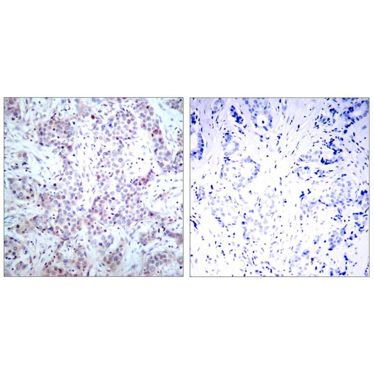 Immunohistochemistry - NFkB-p65 (Ab-536) Antibody from Signalway Antibody (21014) - Antibodies.com