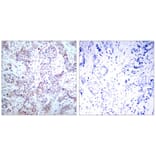 Immunohistochemistry - NFkB-p65 (Ab-536) Antibody from Signalway Antibody (21014) - Antibodies.com