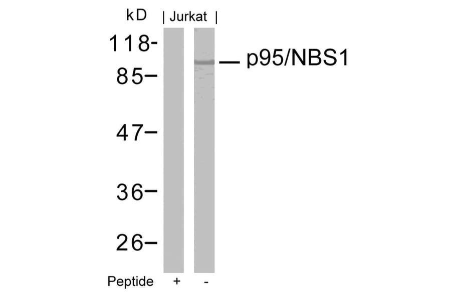 Western blot - p95/NBS1 (Ab-343) Antibody from Signalway Antibody (21058) - Antibodies.com