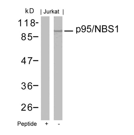 Western blot - p95/NBS1 (Ab-343) Antibody from Signalway Antibody (21058) - Antibodies.com
