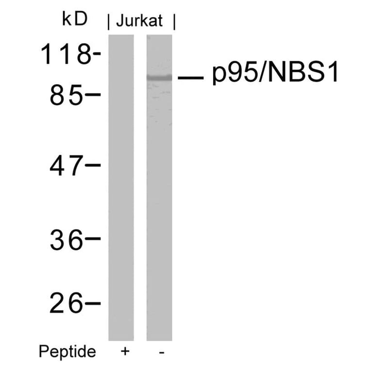 Western blot - p95/NBS1 (Ab-343) Antibody from Signalway Antibody (21058) - Antibodies.com