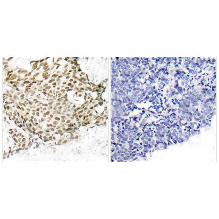 Immunohistochemistry - p95/NBS1 (Ab-343) Antibody from Signalway Antibody (21058) - Antibodies.com