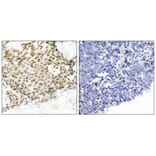 Immunohistochemistry - p95/NBS1 (Ab-343) Antibody from Signalway Antibody (21058) - Antibodies.com