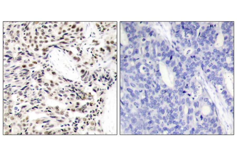 Immunohistochemistry - NFkB-p65 (Ab-529) Antibody from Signalway Antibody (21210) - Antibodies.com