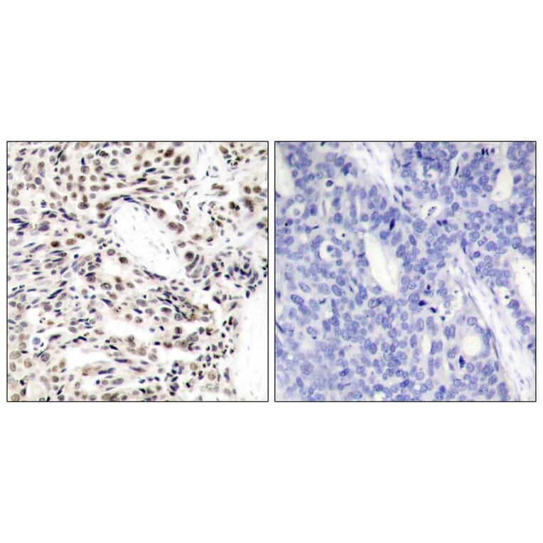 Immunohistochemistry - NFkB-p65 (Ab-529) Antibody from Signalway Antibody (21210) - Antibodies.com
