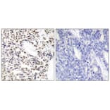 Immunohistochemistry - NFkB-p65 (Ab-529) Antibody from Signalway Antibody (21210) - Antibodies.com