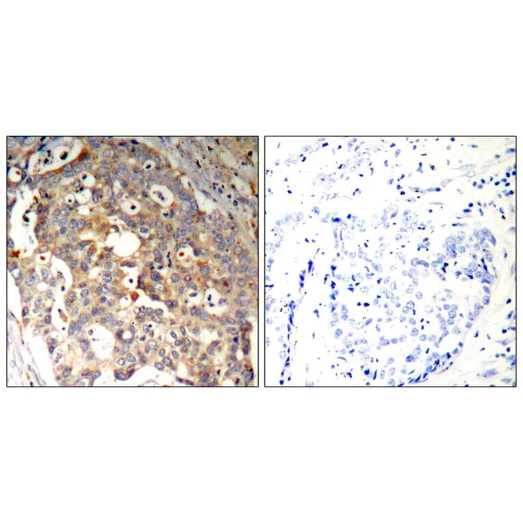 Immunohistochemistry - SAPK/JNK (Ab-183) Antibody from Signalway Antibody (21241) - Antibodies.com