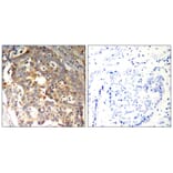 Immunohistochemistry - SAPK/JNK (Ab-183) Antibody from Signalway Antibody (21241) - Antibodies.com