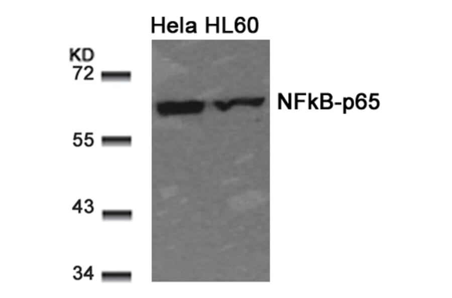 Western blot - NFkB-p65 (Ab-311) Antibody from Signalway Antibody (21252) - Antibodies.com