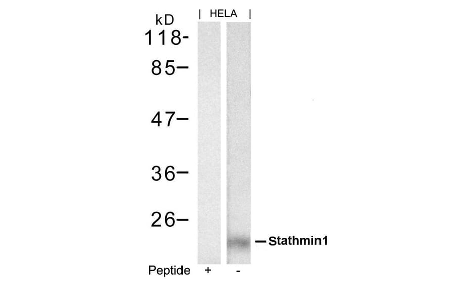 Western blot - stathmin1 (Ab-62) Antibody from Signalway Antibody (21518) - Antibodies.com