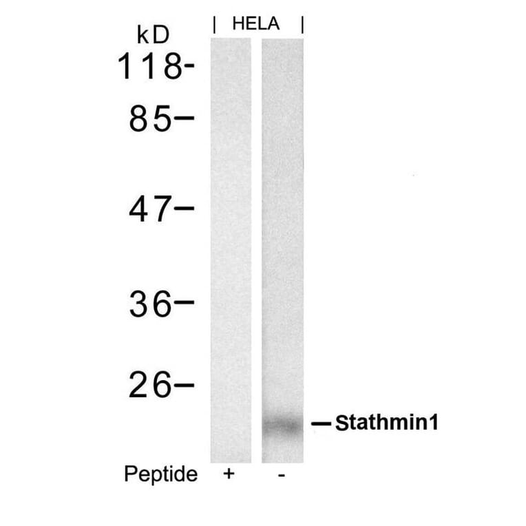 Western blot - stathmin1 (Ab-62) Antibody from Signalway Antibody (21518) - Antibodies.com