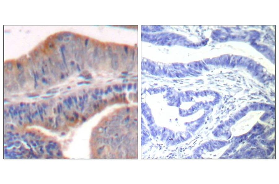 Immunohistochemistry - stathmin1 (Ab-62) Antibody from Signalway Antibody (21518) - Antibodies.com
