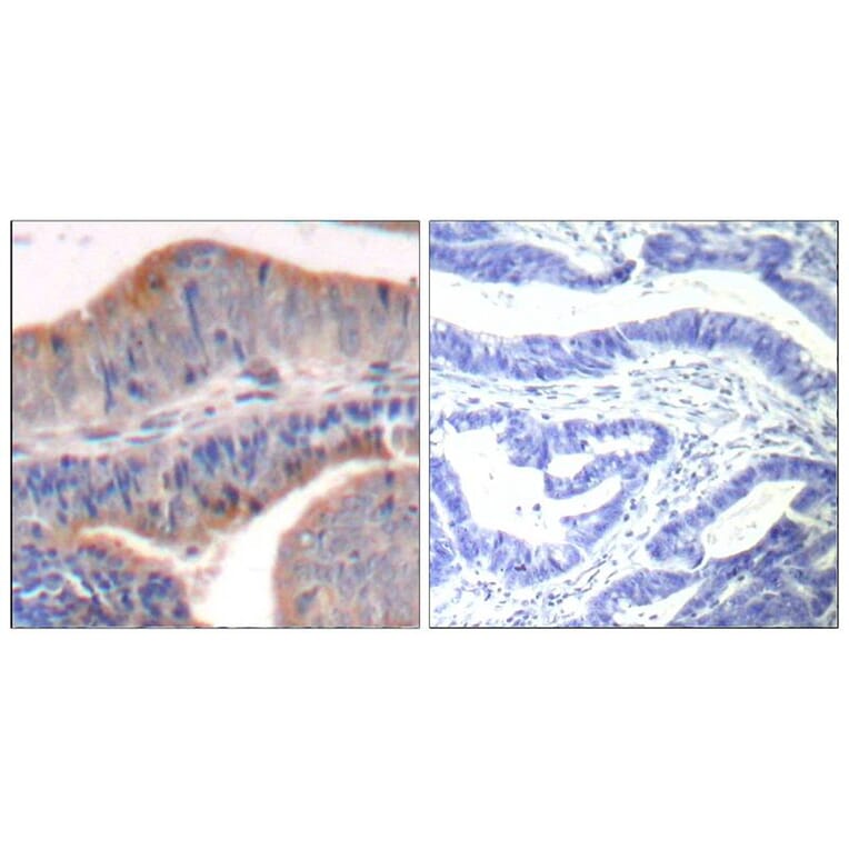 Immunohistochemistry - stathmin1 (Ab-62) Antibody from Signalway Antibody (21518) - Antibodies.com