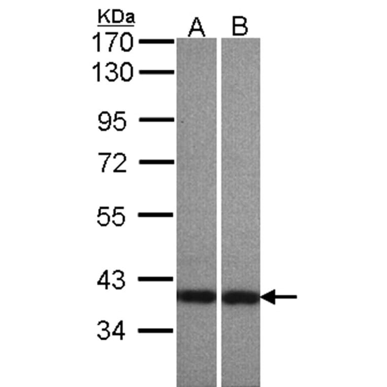 Centaurin alpha1 antibody from Signalway Antibody (23112) - Antibodies.com