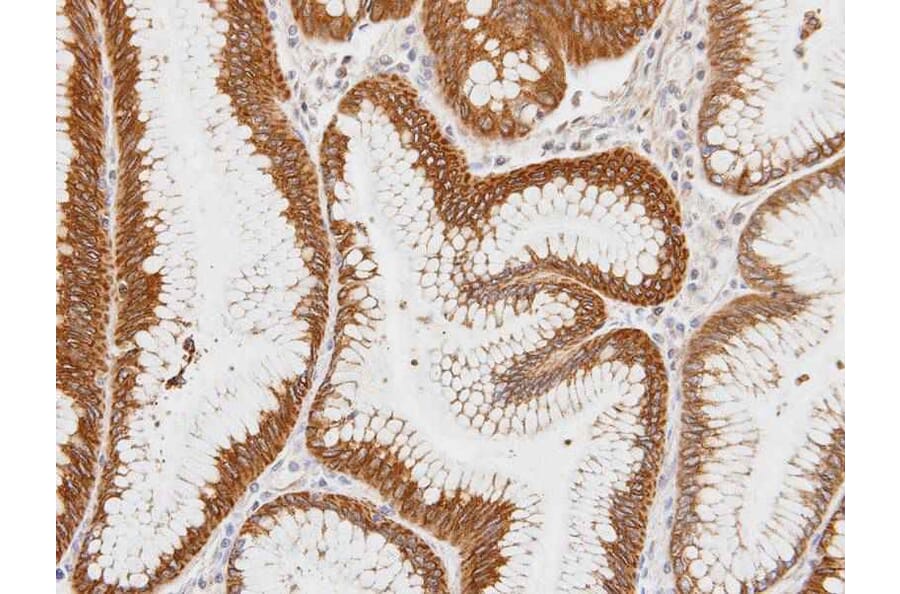 Immunohistochemistry - Centaurin alpha1 antibody from Signalway Antibody (23112) - Antibodies.com
