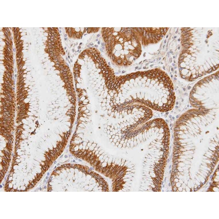 Immunohistochemistry - Centaurin alpha1 antibody from Signalway Antibody (23112) - Antibodies.com