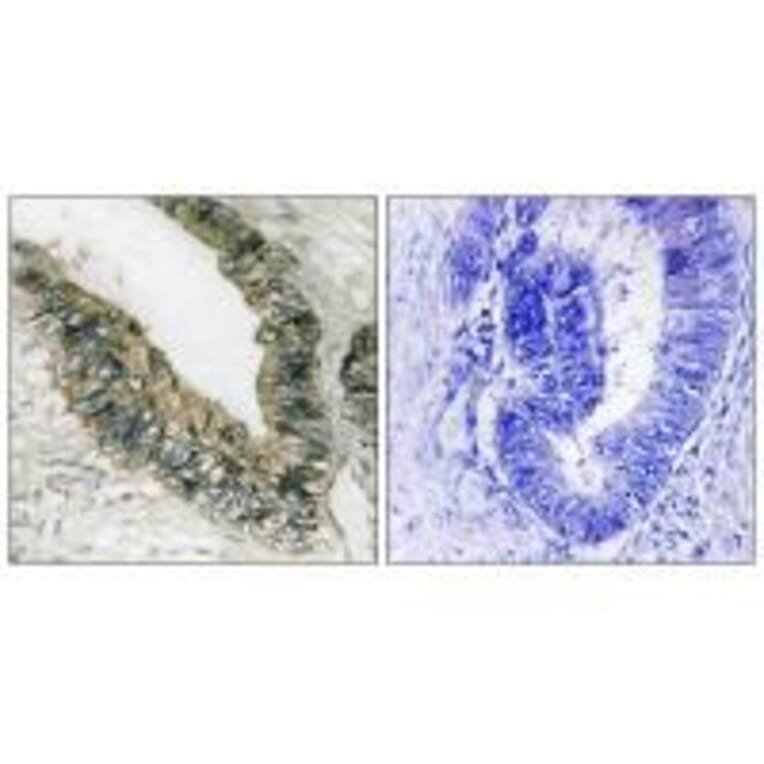 Immunohistochemistry - PEK/PERK (Ab-981) Antibody from Signalway Antibody (33247) - Antibodies.com