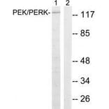 Western blot - PEK/PERK (Ab-981) Antibody from Signalway Antibody (33247) - Antibodies.com