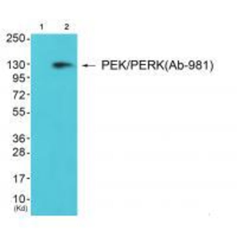 Western blot - PEK/PERK (Ab-981) Antibody from Signalway Antibody (33247) - Antibodies.com