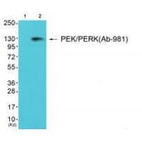 Western blot - PEK/PERK (Ab-981) Antibody from Signalway Antibody (33247) - Antibodies.com