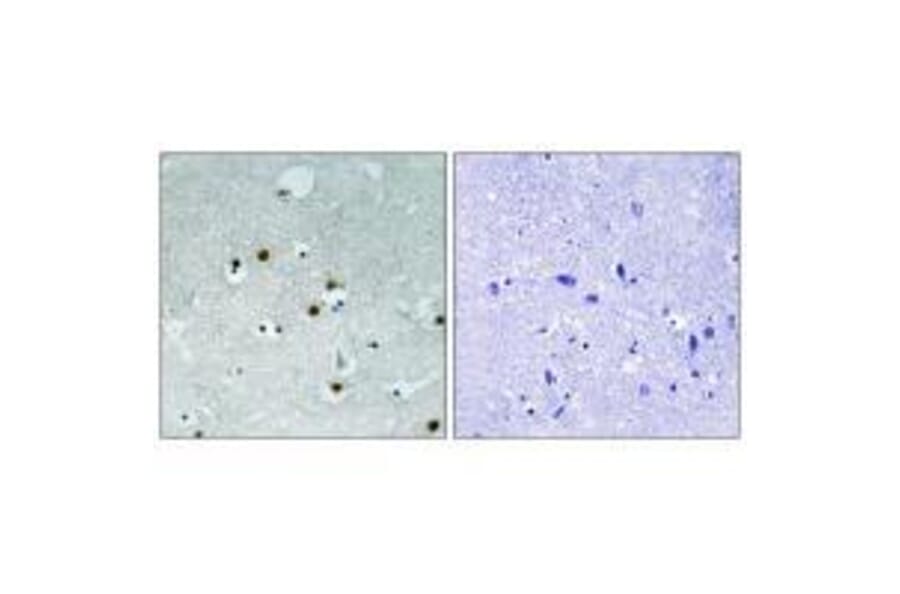 Immunohistochemistry - HP1 alpha (Ab-92) Antibody from Signalway Antibody (33268) - Antibodies.com