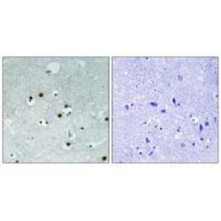 Immunohistochemistry - HP1 alpha (Ab-92) Antibody from Signalway Antibody (33268) - Antibodies.com