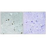 Immunohistochemistry - HP1 alpha (Ab-92) Antibody from Signalway Antibody (33268) - Antibodies.com