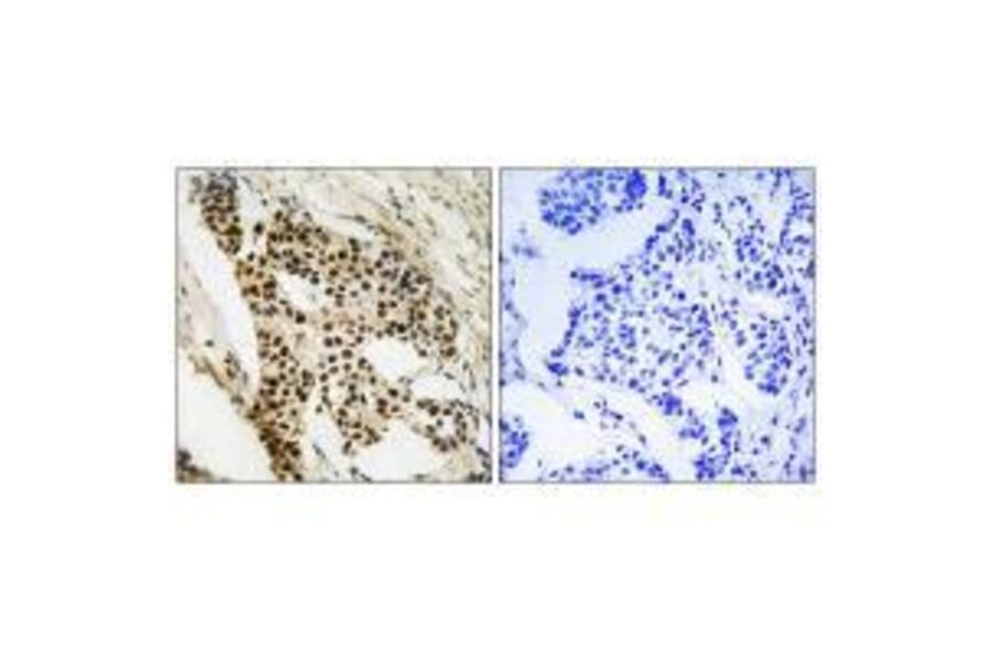 Immunohistochemistry - MAPKAPK2 (Ab-272) Antibody from Signalway Antibody (33286) - Antibodies.com