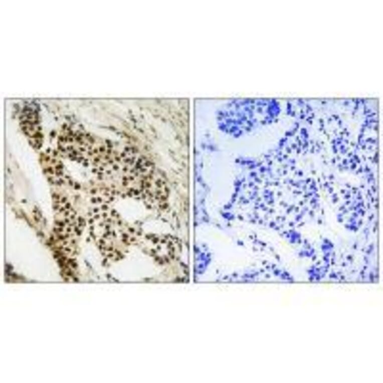 Immunohistochemistry - MAPKAPK2 (Ab-272) Antibody from Signalway Antibody (33286) - Antibodies.com