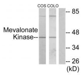 Western blot - Mevalonate Kinase Antibody from Signalway Antibody (33852) - Antibodies.com