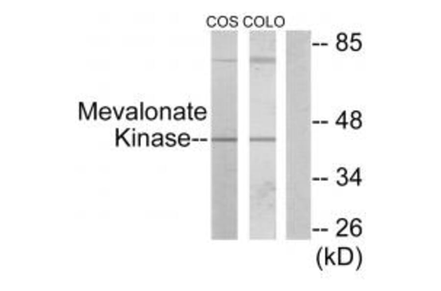 Western blot - Mevalonate Kinase Antibody from Signalway Antibody (33852) - Antibodies.com