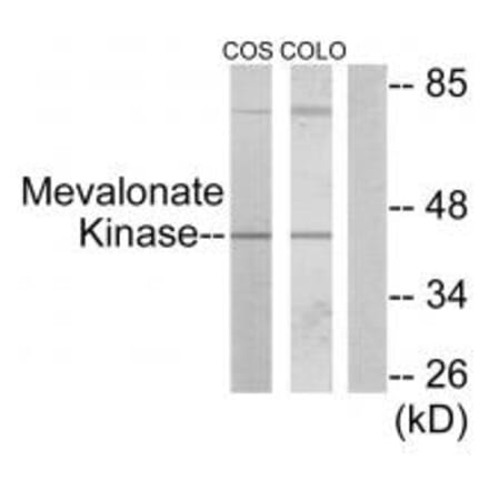 Western blot - Mevalonate Kinase Antibody from Signalway Antibody (33852) - Antibodies.com