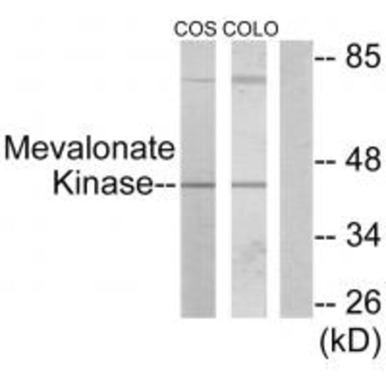 Western blot - Mevalonate Kinase Antibody from Signalway Antibody (33852) - Antibodies.com